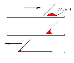 Preparing a Blood Smear